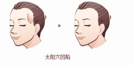 下载
